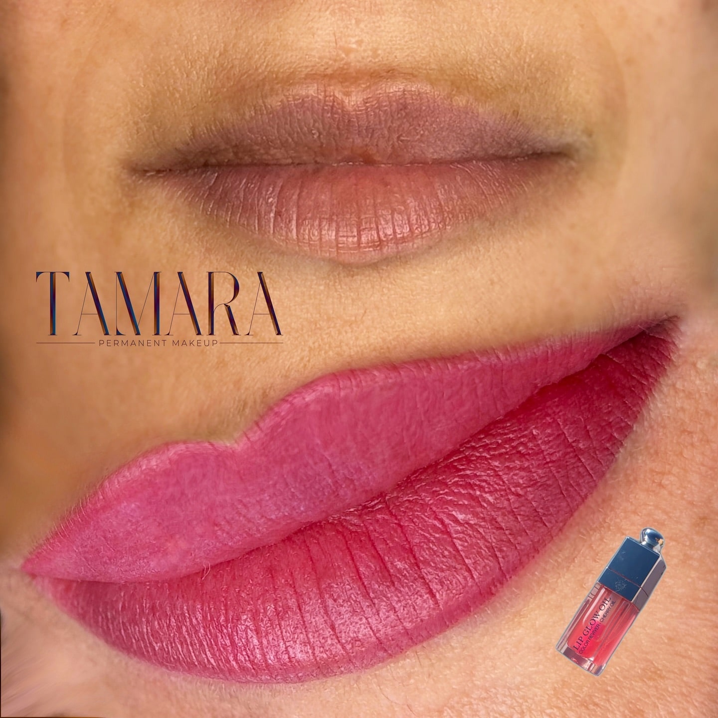 Lips