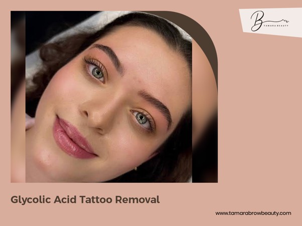 Glycolic Acid Tattoo Removal